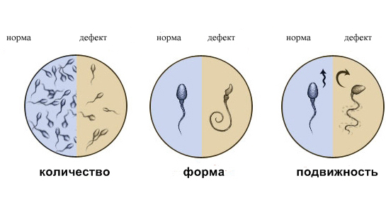 Исследование спермы, спермограмма и МАР-тест